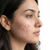 Face care